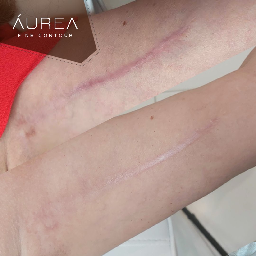 Resultado Áurea Skin