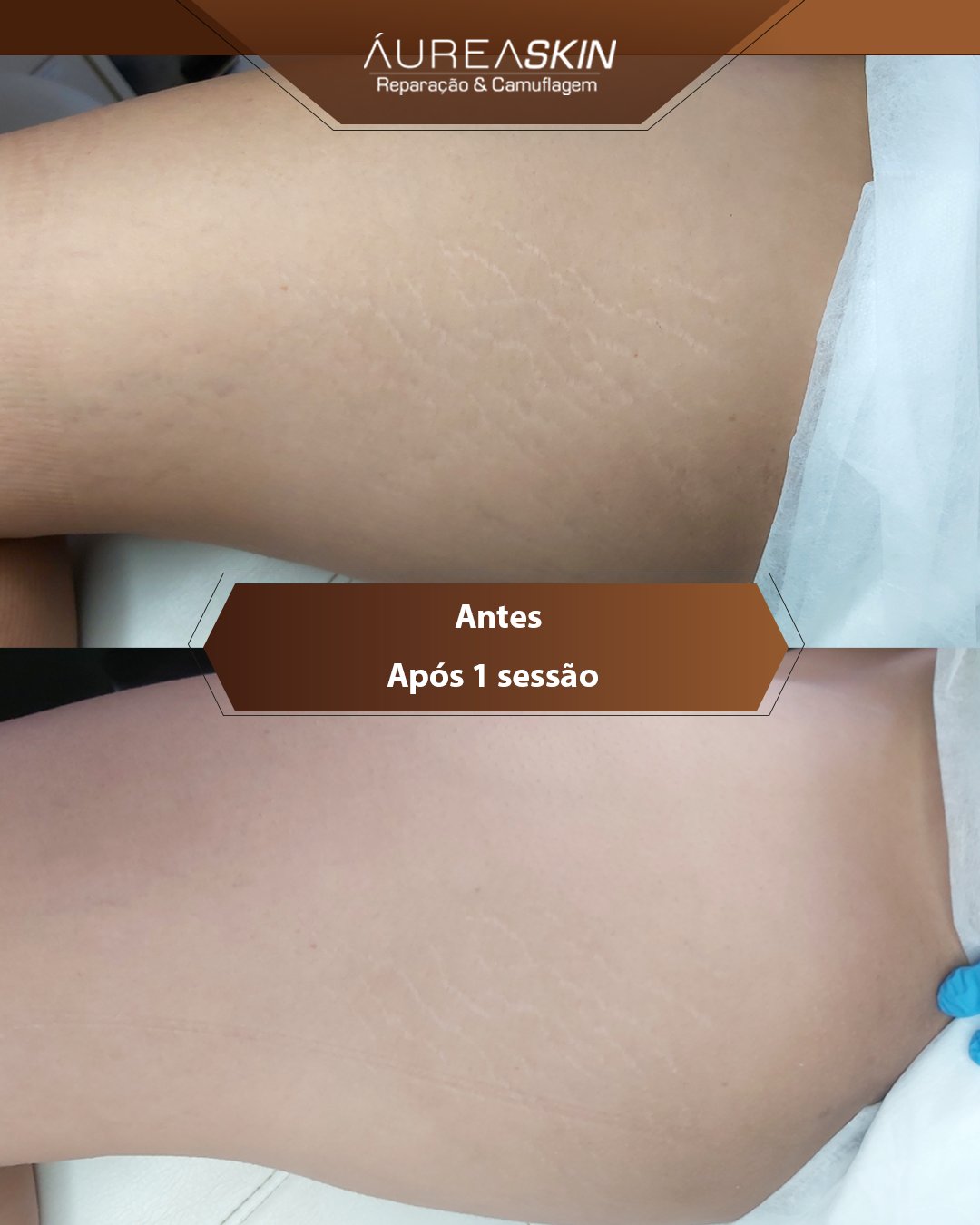 Resultado Áurea Skin