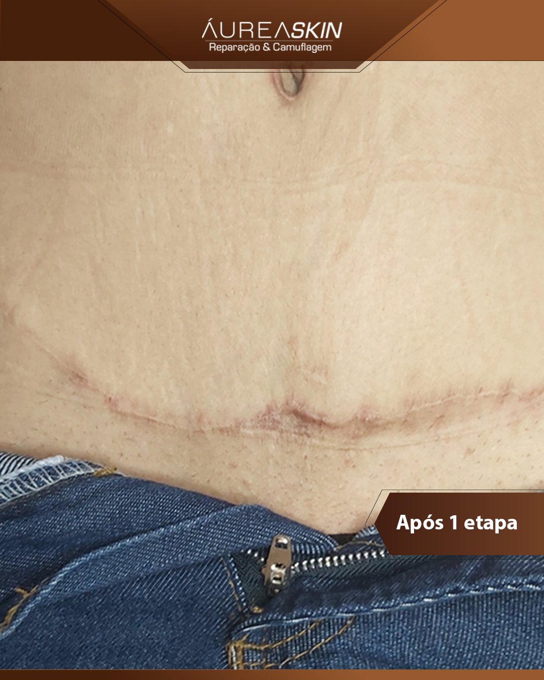 Resultado Áurea Skin