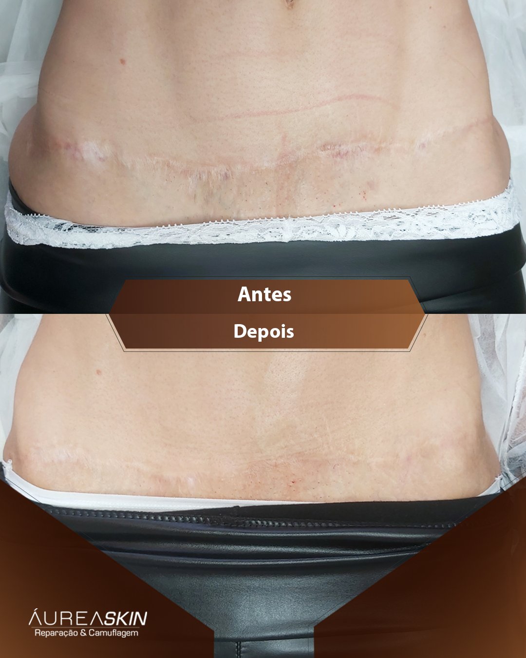 Resultado Áurea Skin