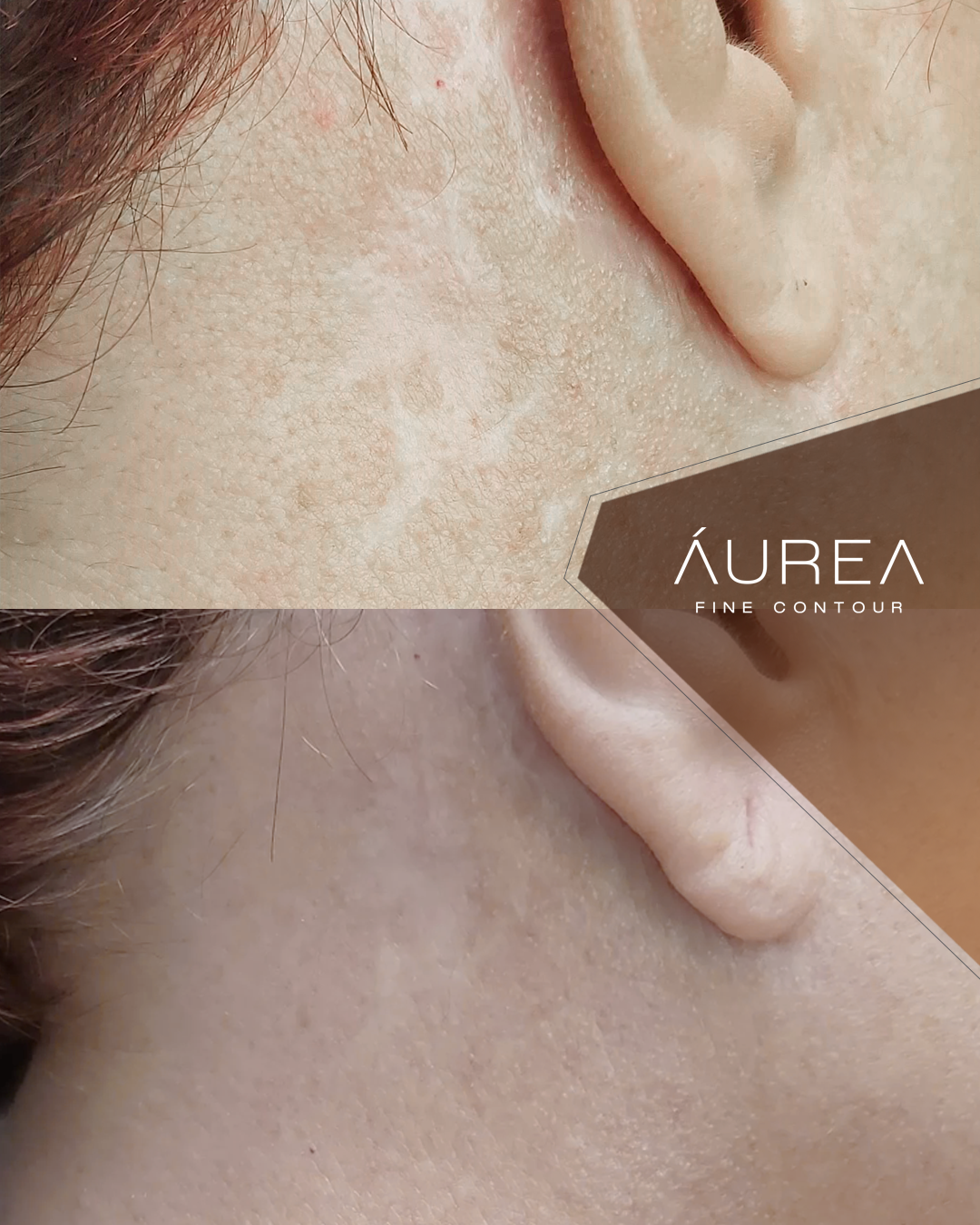 Resultado Áurea Skin